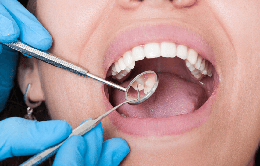 how long does a dental cleaning take