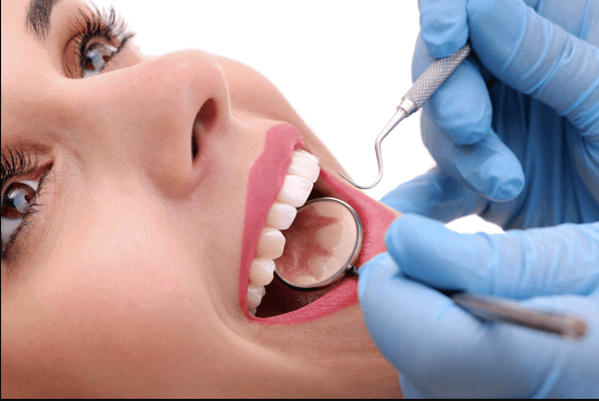 dental laser cleaning